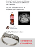 DIET SODA RING + FREE STICKER